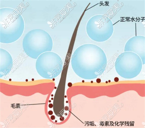 头发毛囊卡通图