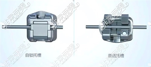 烏魯木齊自鎖矯正器和托槽矯正器對(duì)比圖