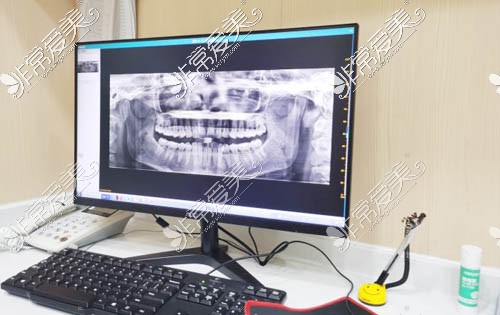 深圳诺德口腔牙齿治疗CT拍摄