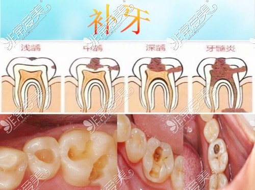 天门哪个口腔医院好?天门市百姓补牙正畸种牙爱去这5家牙科