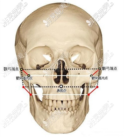 颧骨颧弓部位示意图