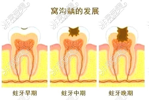 公布昌吉牙科诊所收费表,含昌吉洗牙拔牙种牙价格收费明细!