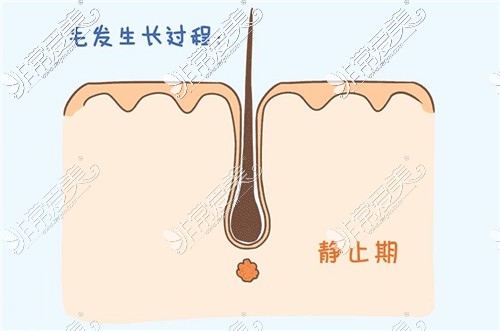 毛發(fā)生長過程圖