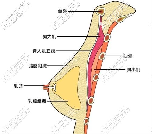 乌鲁木齐伊丽莎白整形医院隆胸示意图