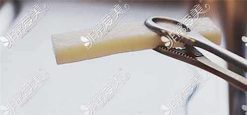 韩国世檀塔男科使用的生物补片厚度展示