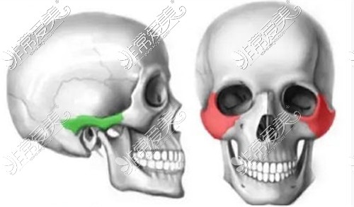 颧骨颧弓示意图