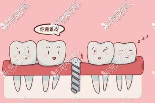 种植牙改善治疗卡通图