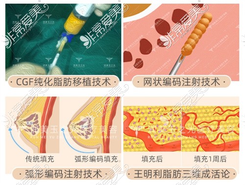 北京润美玉之光王明利医生擅长技术