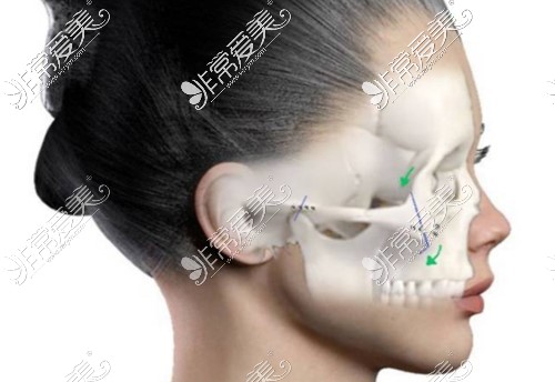 颧骨在面部的具体位置