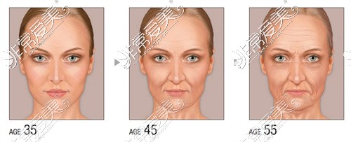 不同年龄层的皮肤衰老问题