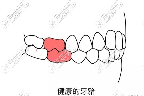 正常的牙颌展示图