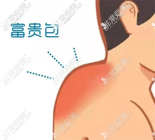 富贵包动画图