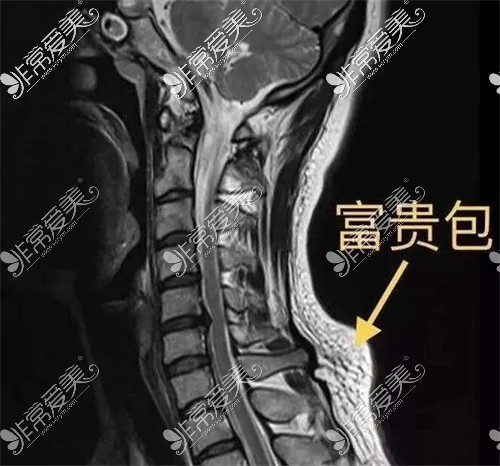 富贵包形态展示图