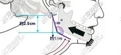 杭州哪里看颌面科好？网友反馈：杭州整形医院颌面整形好