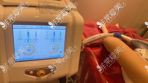 韩国365mc吸脂医院冷冻脂肪治疗