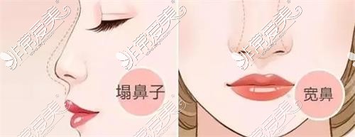 明醫(yī)星醫(yī)療整形整形圖