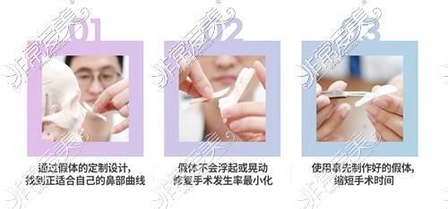 韩国乐日整形外科3D打印鼻部整形手术特色优势介绍！