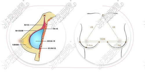 北京隆胸醫(yī)生董巖巖美學(xué)設(shè)計