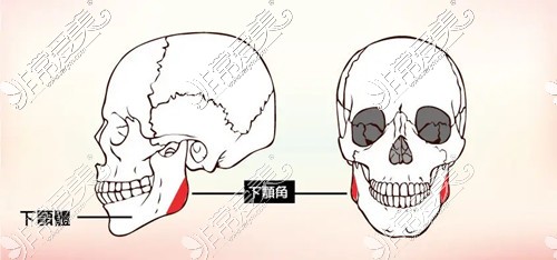 削骨瘦脸风险大吗?长沙削骨磨骨瘦脸手术大概要多少钱?