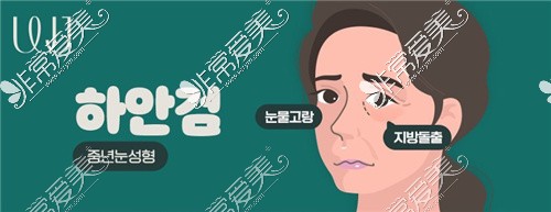 韩国WJ原辰整形下眼睑定制手术