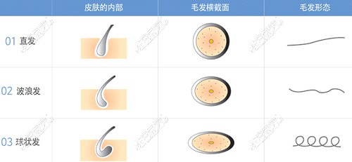 不同的毛发生长情况形态