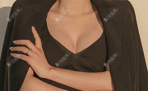 韩国隆胸整形医院推荐：NANA娜娜做胸在本地排名前三！