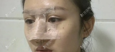 韩国自然的整容脸是什么样子 想做自然整形手术选哪家医院