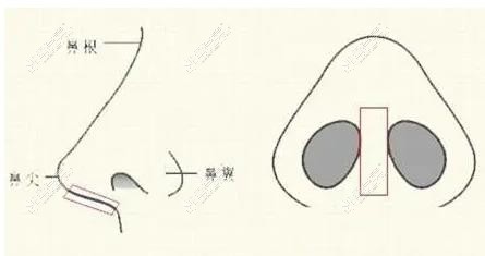 貴州整形美容醫(yī)院鼻子整形示意圖