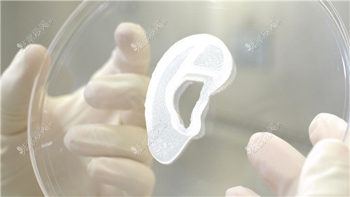 3D耳再造假体展示