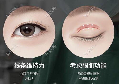 韩国TS整形外科双眼皮特点宣传