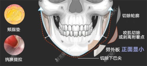 长曲线下颌角卡通图