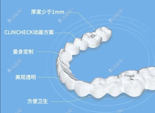 隐形矫治器优势图