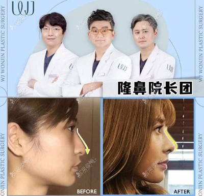 韩国眼鼻胸吸脂项目推荐哪家?韩国WJ原辰整形这几项都出名!