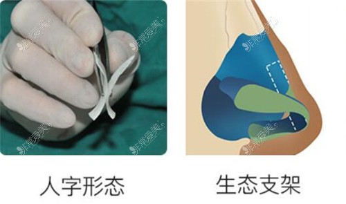 韩国好的鼻修复医院名单公布，共5家，每家都有独特的优势