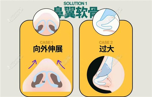 韩国好的鼻修复医院名单公布，共5家，每家都有独特的优势