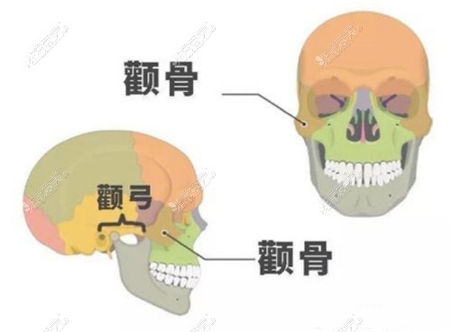 颧骨颧弓展示图