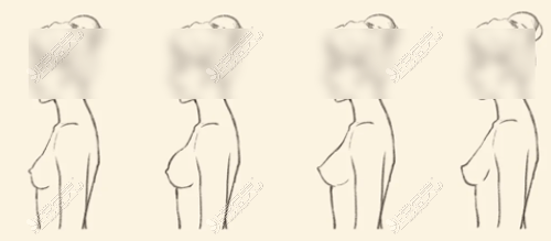 不同胸型照片