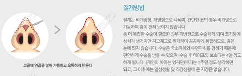 韩国碧夏鼻子修复手术好吗？剖析碧夏整形所有背景资料！