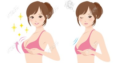 韩国欧佩拉整形医院隆胸术后图