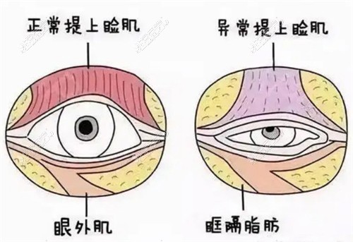 眼部组织图示