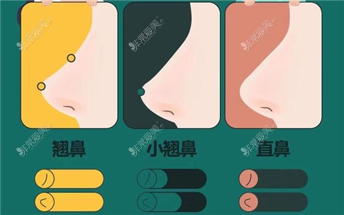韩国id做鼻子鼻型示意图