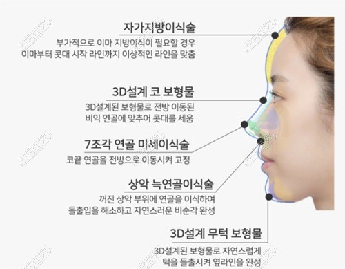 韩国温度整形外科轮廓定制鼻子介绍