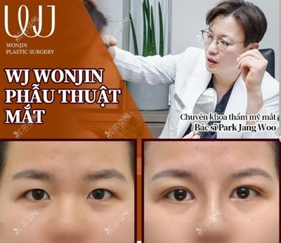 分享韩国眼鼻整形医院—韩国WJ原辰,附各院长眼鼻手术对比!
