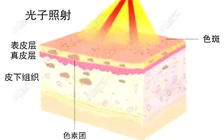 新疆黎美整形美容医院整形手术图