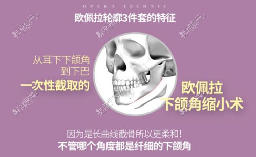 韩国欧佩拉整形下颌角手术特点分析