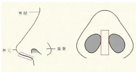 青岛博士医美医院隆鼻示意图