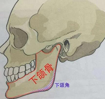 下頜角磨骨改善治療展示圖