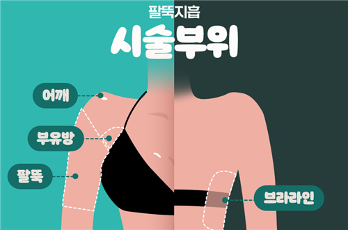 揭秘韩国WJ原辰手臂吸脂,线条笔直的技巧和法宝!
