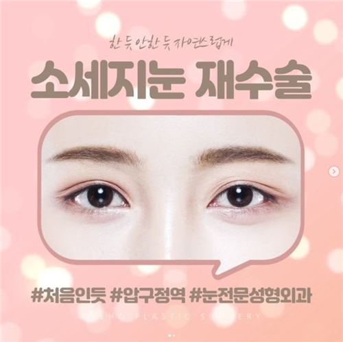 韩国EH爱护整形外科眼部整形宣传图