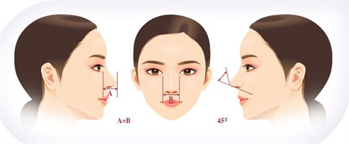 鼻型设计示意图